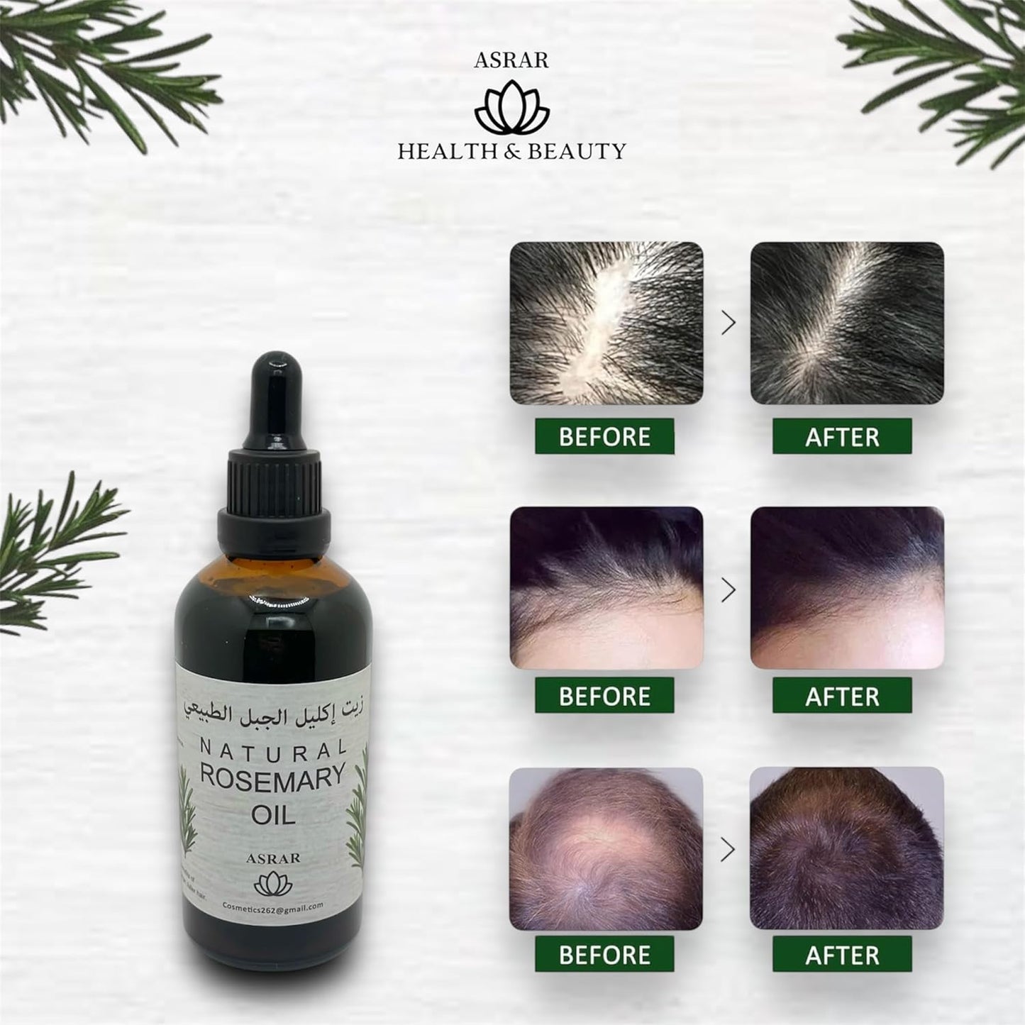 ASRAR Natural Rosemary Oil - 100% Pure - Organic Essential Oil for Hair Growth & Beard Growth - Fills Sparse Areas - Strengthens & Thickens Hair and Beard